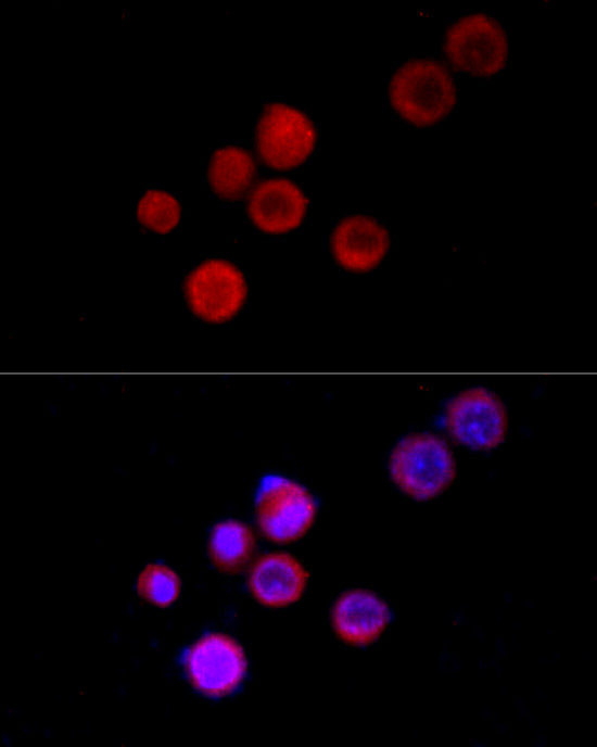 TRPC5 Rabbit pAb