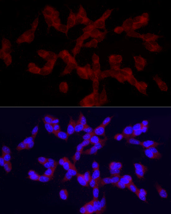 TRPC5 Rabbit pAb