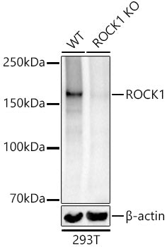 [KO Validated] ROCK1 Rabbit pAb