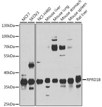 RPRD1B Rabbit pAb
