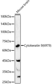 Cytokeratin 9 (KRT9) Rabbit pAb