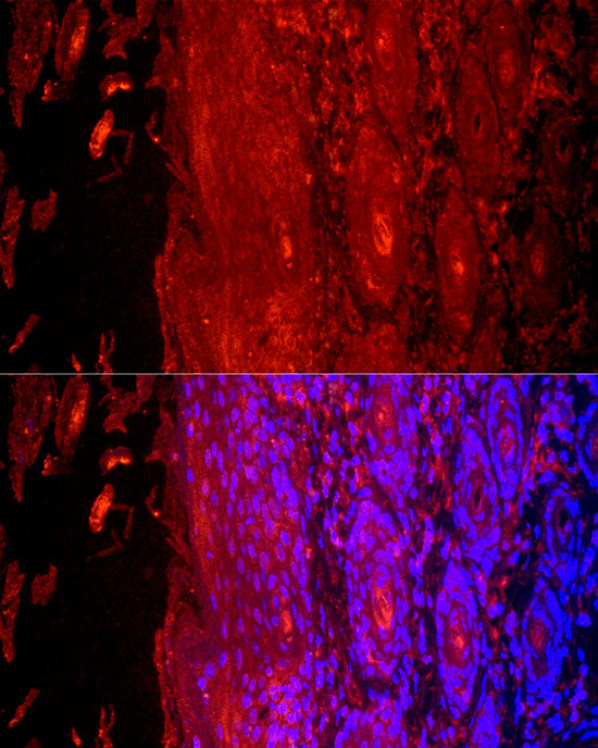 Cytokeratin 9 (KRT9) Rabbit pAb