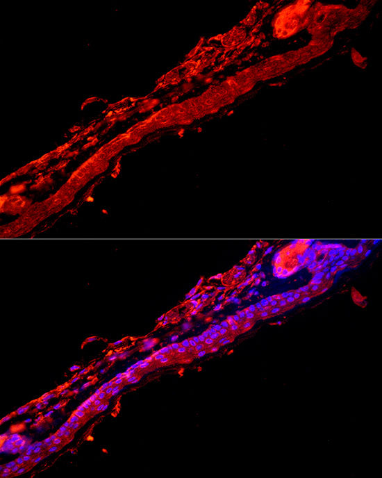 Cytokeratin 9 (KRT9) Rabbit pAb