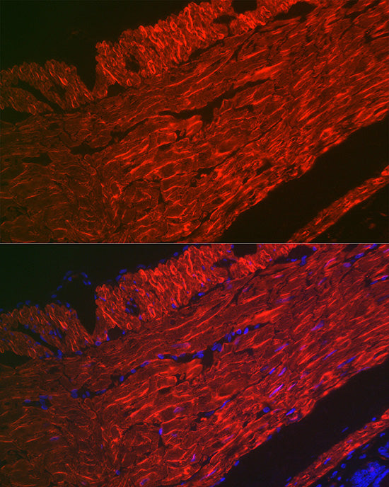 α-Smooth Muscle Actin (ACTA2) Rabbit pAb