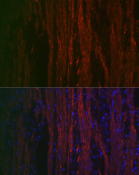 α-Smooth Muscle Actin (ACTA2) Rabbit pAb