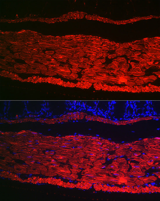 α-Smooth Muscle Actin (ACTA2) Rabbit pAb