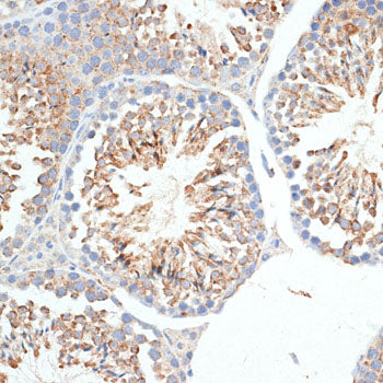 KLHL9 Rabbit pAb