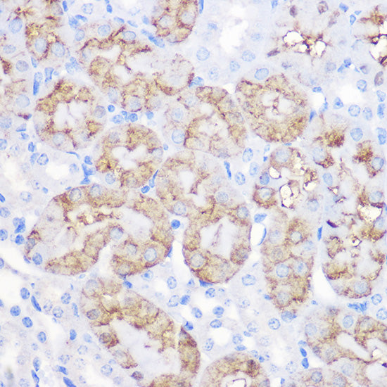 Alpha-1 Antitrypsin (SERPINA1) Rabbit pAb
