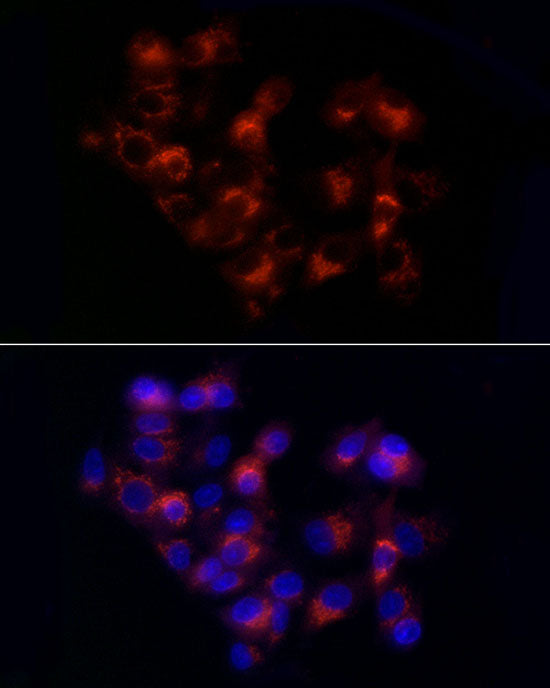 Alpha-1 Antitrypsin (SERPINA1) Rabbit pAb