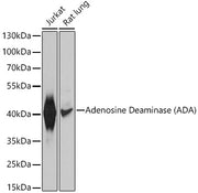 Adenosine Deaminase (ADA) Rabbit pAb