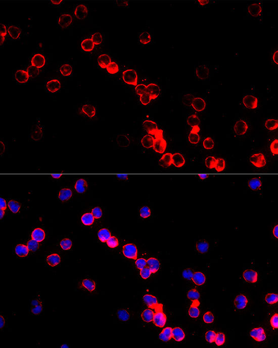 Adenosine Deaminase (ADA) Rabbit pAb