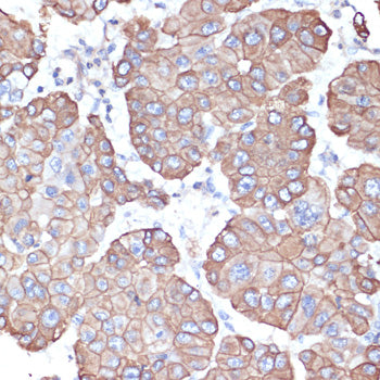 Cytokeratin 18 (KRT18) Rabbit pAb