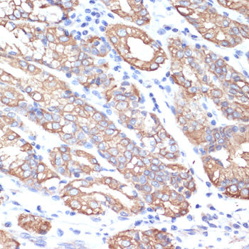 Cytokeratin 18 (KRT18) Rabbit pAb