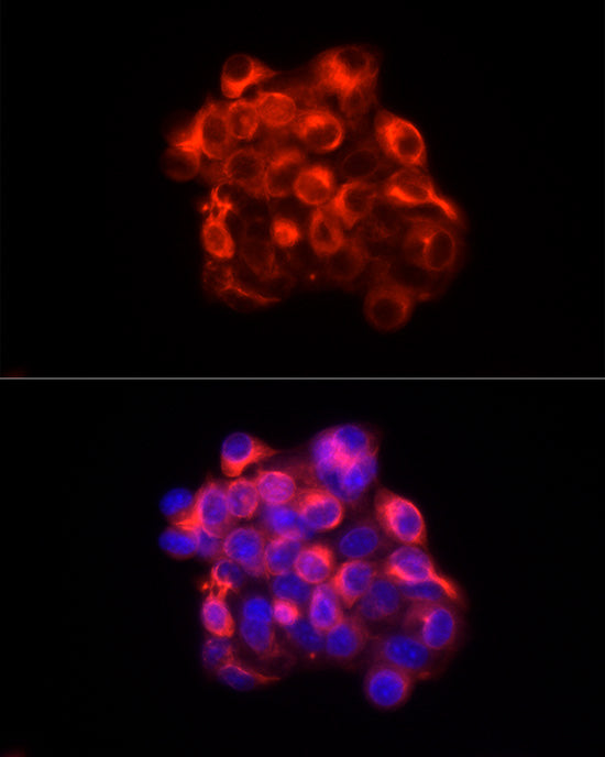 Cytokeratin 18 (KRT18) Rabbit pAb