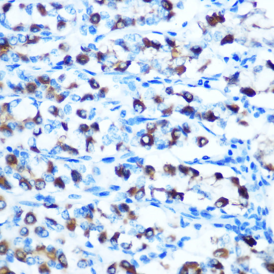DMT1/SLC11A2 Rabbit pAb