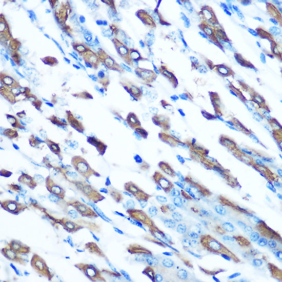 DMT1/SLC11A2 Rabbit pAb