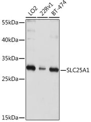 SLC25A1 Rabbit pAb