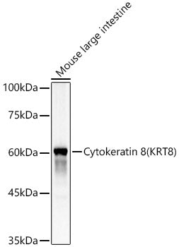 Cytokeratin 8 (KRT8) Rabbit pAb