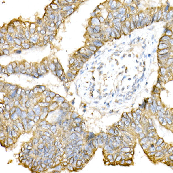 Cytokeratin 8 (KRT8) Rabbit pAb