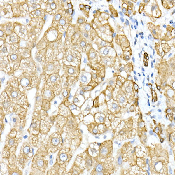 Cytokeratin 8 (KRT8) Rabbit pAb