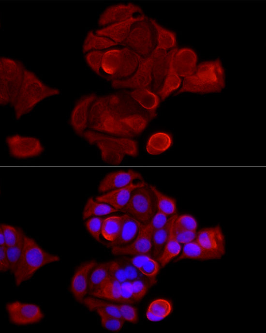 Cytokeratin 8 (KRT8) Rabbit pAb