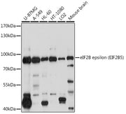 eIF2B epsilon (EIF2B5) Rabbit pAb