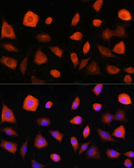 eIF2B epsilon (EIF2B5) Rabbit pAb