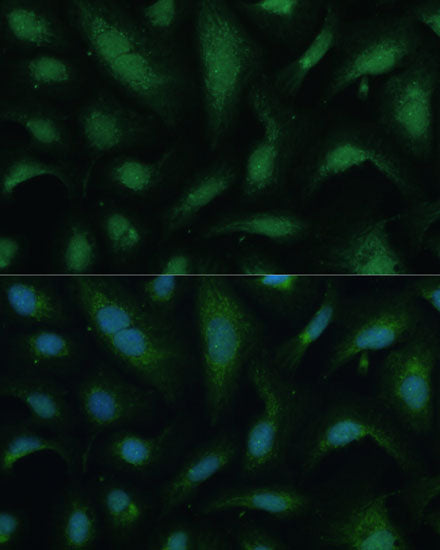 KIF14 Rabbit pAb