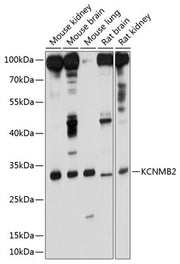 KCNMB2 Rabbit pAb