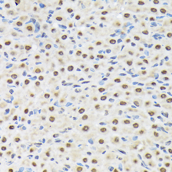 Matrin 3 Rabbit mAb