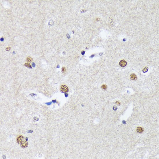 Matrin 3 Rabbit mAb