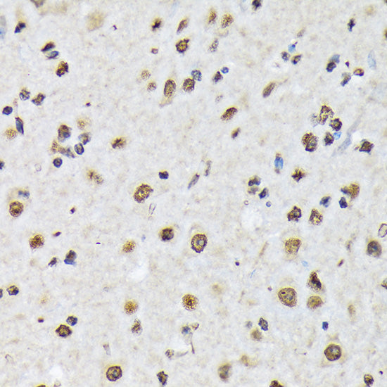 Matrin 3 Rabbit mAb