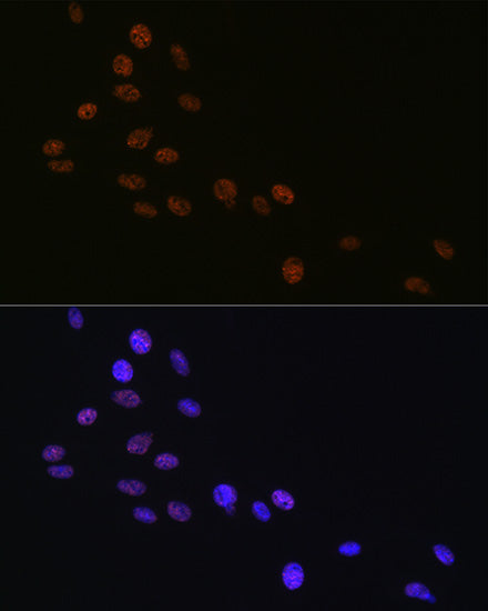 Matrin 3 Rabbit mAb