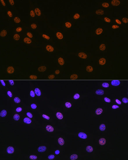 Matrin 3 Rabbit mAb