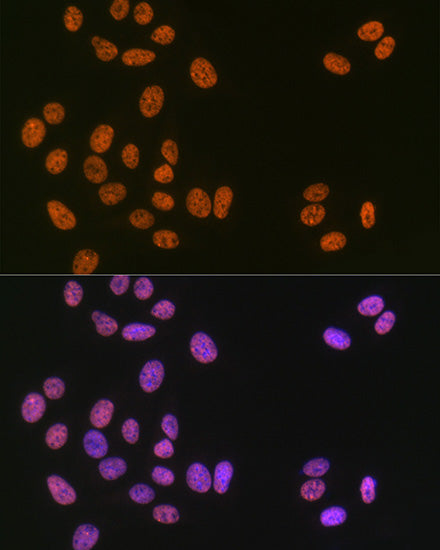 Matrin 3 Rabbit mAb