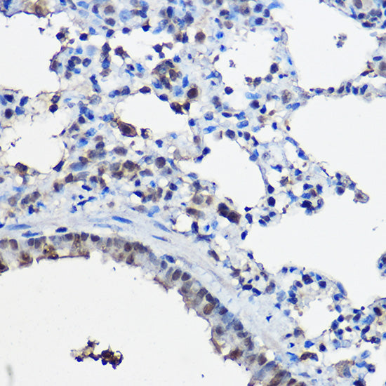 [KO Validated] NCOA2 Rabbit pAb