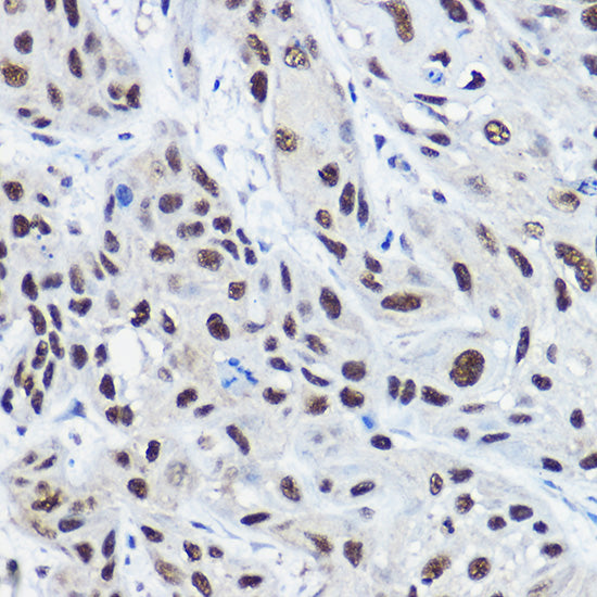 [KO Validated] NCOA2 Rabbit pAb