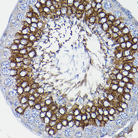ICMT Rabbit pAb