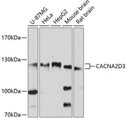 CACNA2D3 Rabbit pAb