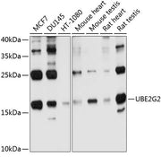 UBE2G2 Rabbit pAb