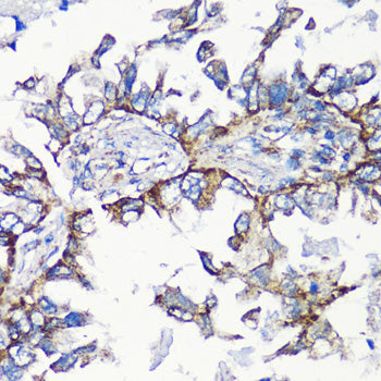 MMP16 Rabbit pAb