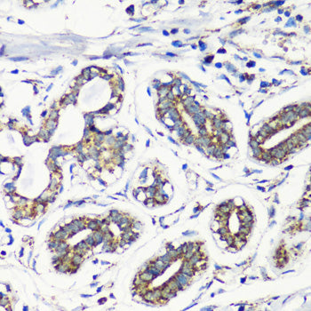 MMP16 Rabbit pAb