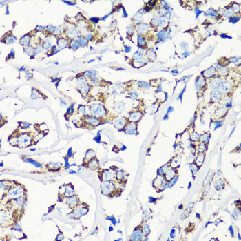 MMP16 Rabbit pAb