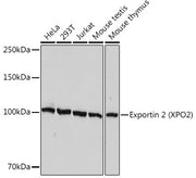 Exportin 2 (XPO2) Rabbit mAb