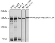 ORP150/GRP170/HSP12A Rabbit mAb