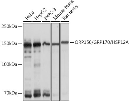 ORP150/GRP170/HSP12A Rabbit mAb