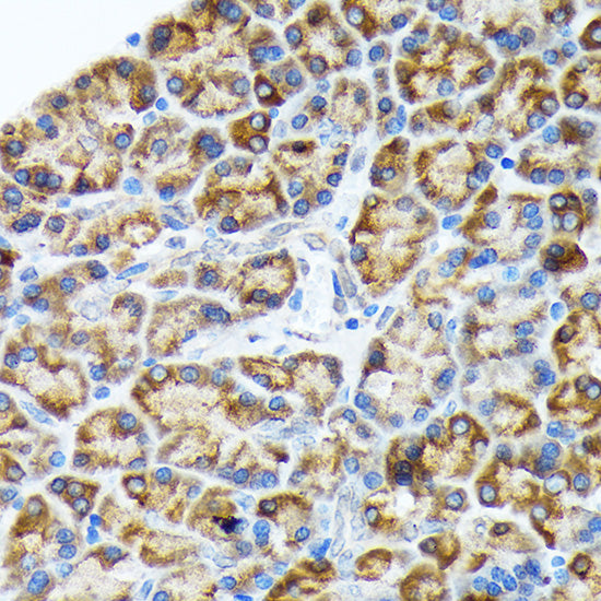 ORP150/GRP170/HSP12A Rabbit mAb