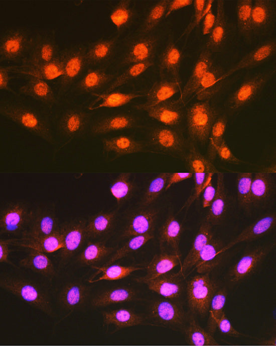 hnRNP E1/PCBP1 Rabbit pAb