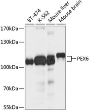 PEX6 Rabbit pAb