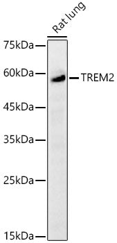 TREM2 Rabbit pAb